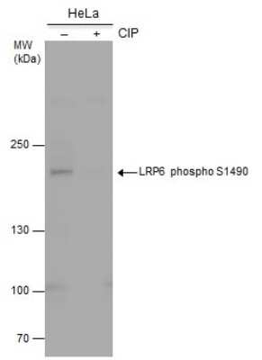 Western Blot: LRP-6 [p Ser1490] Antibody [NBP3-12921]
